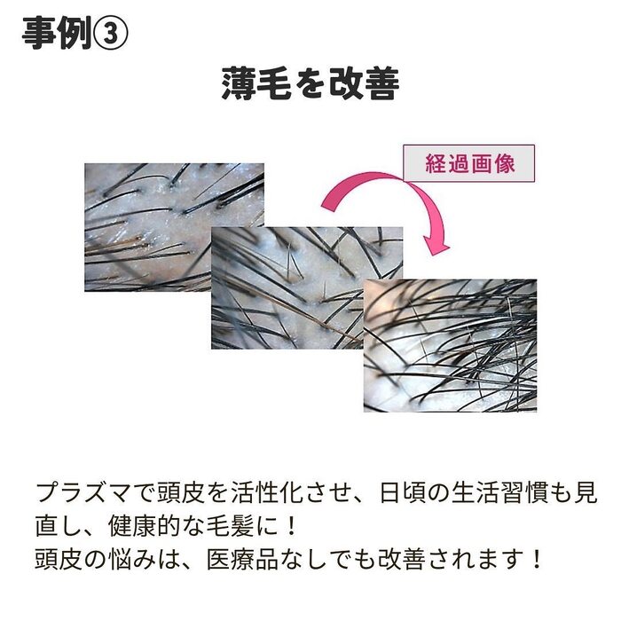 画像1306