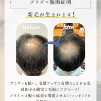 画像1812