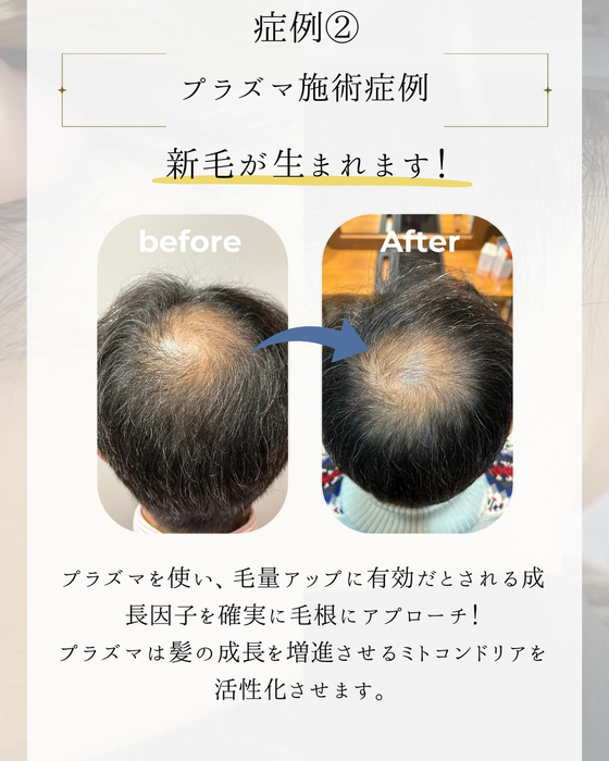 画像1812