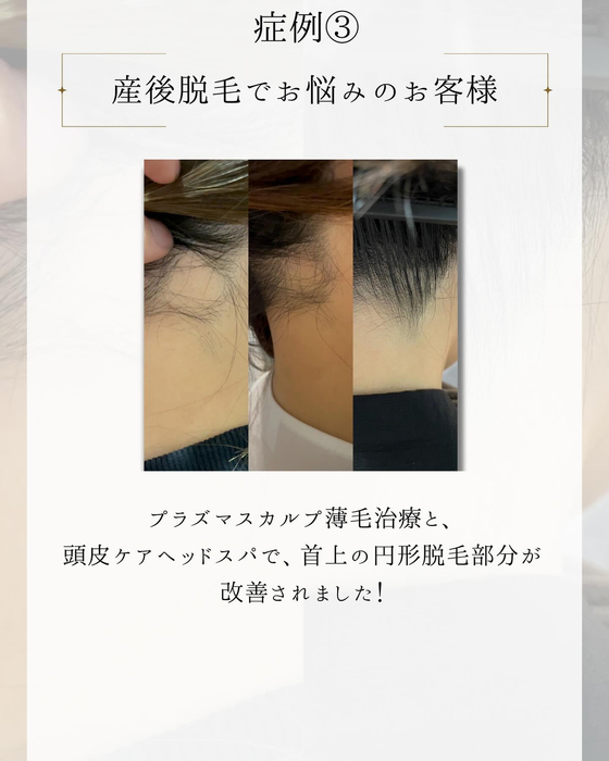 画像1814
