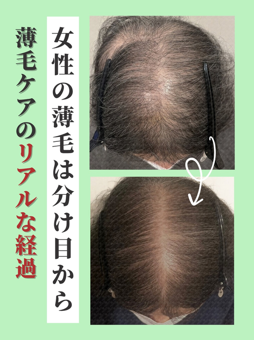 画像2956