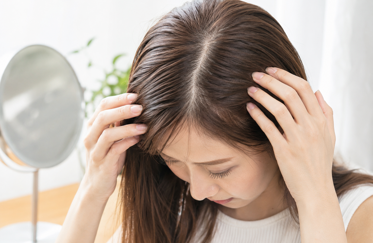分け目が広がってきた女性に考えられる原因とは？｜町田のヘアサロンなら頭皮ケアに特化した＆Happily